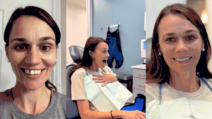 Before and after