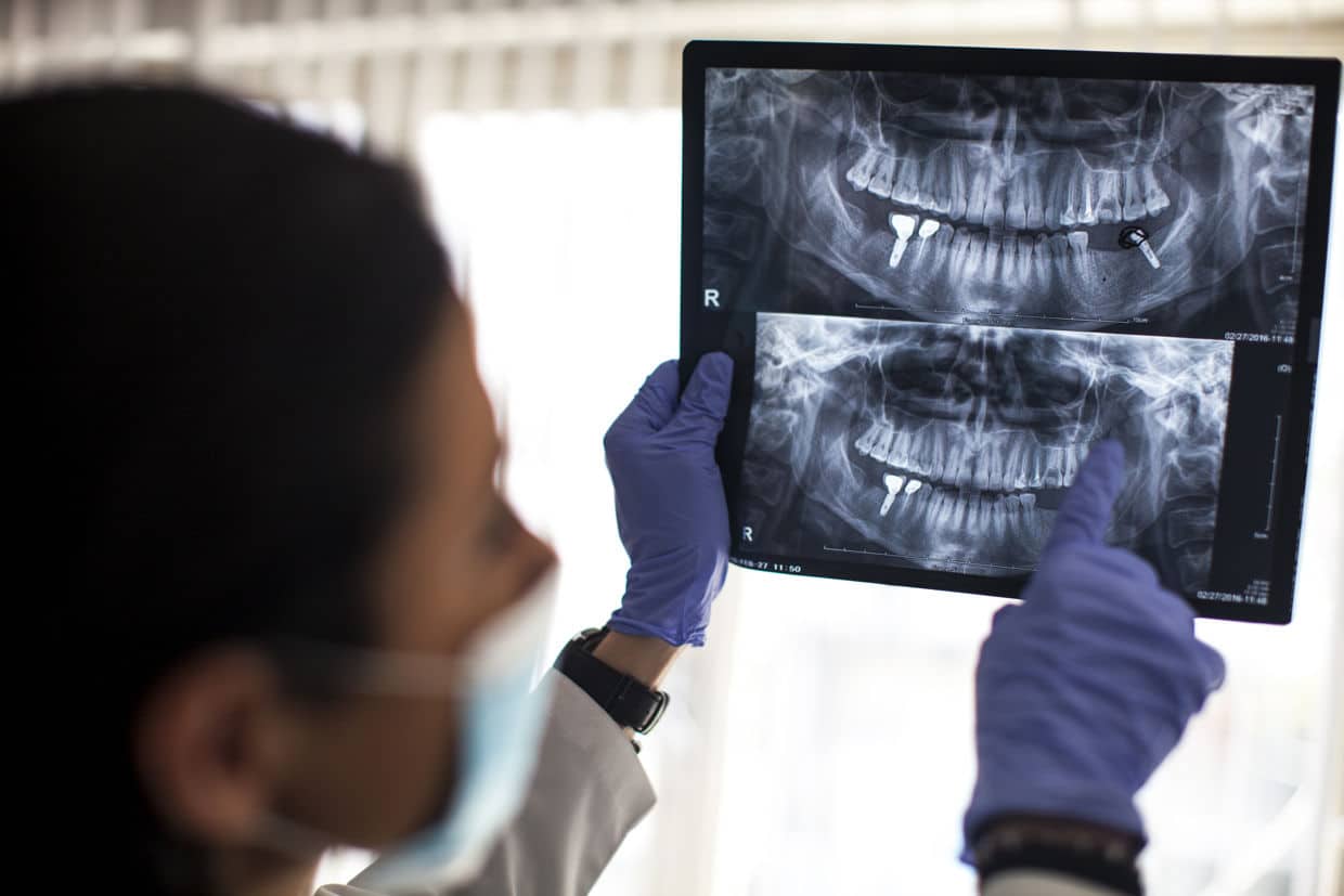 dentist with xrays explaining dental implant safety