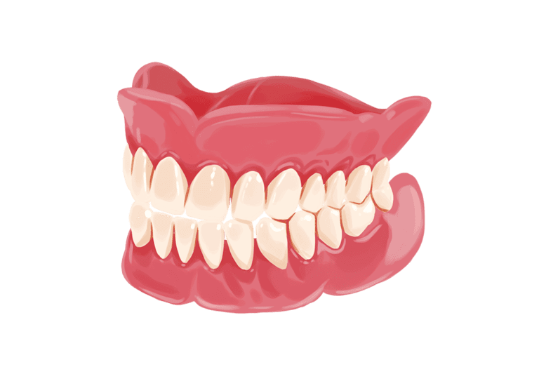 model of immediate dentures