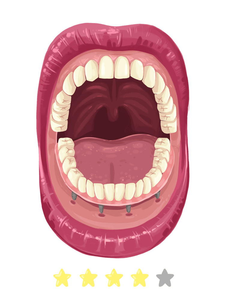 teeth replacement model