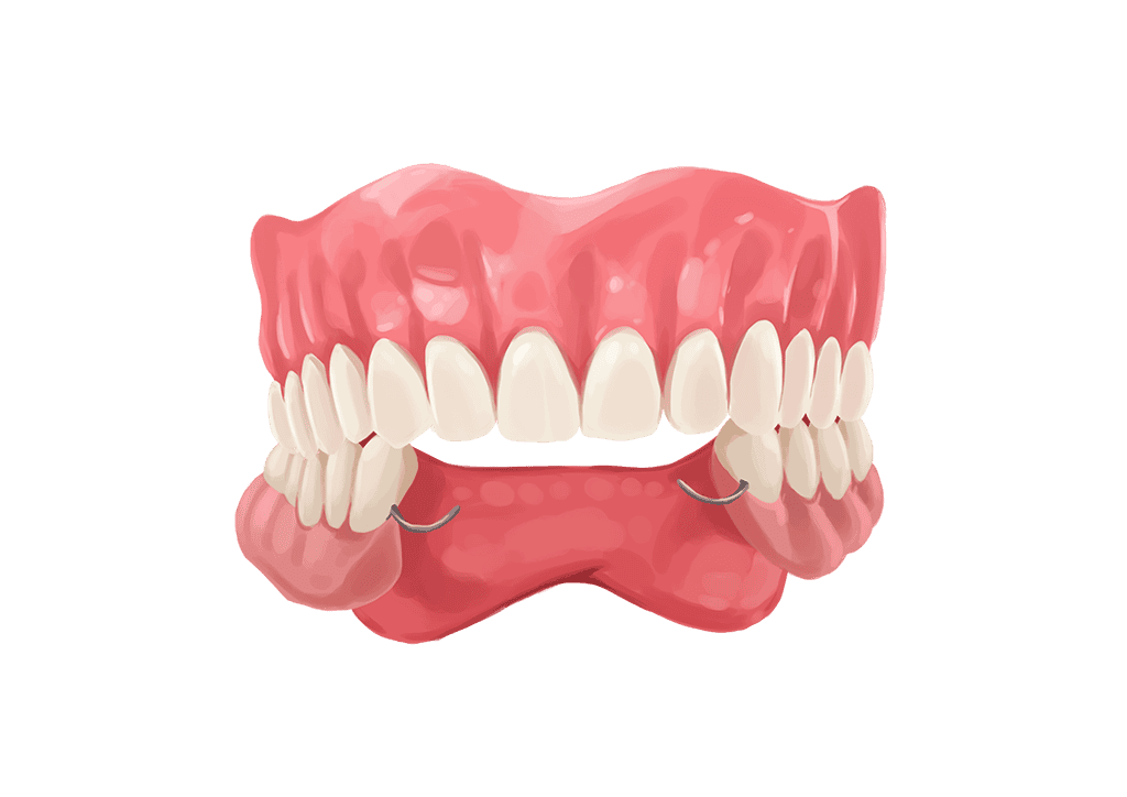 traditional dentures model