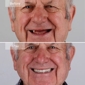 G4dental