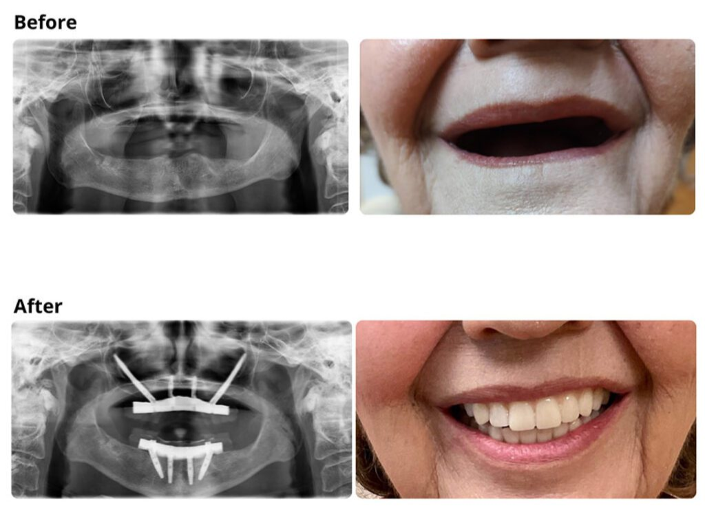 g4dental