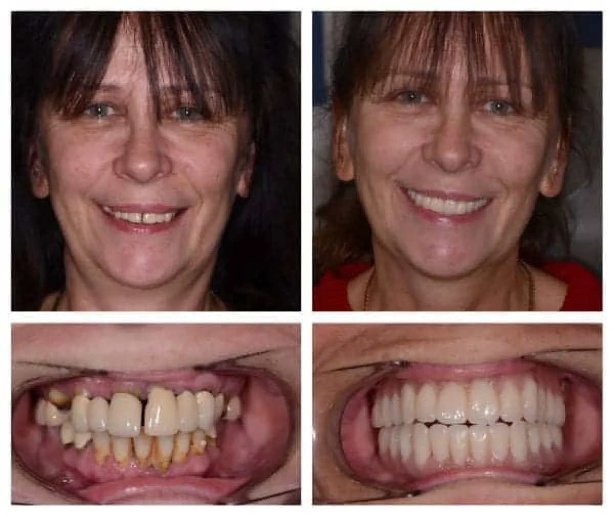 g4dental